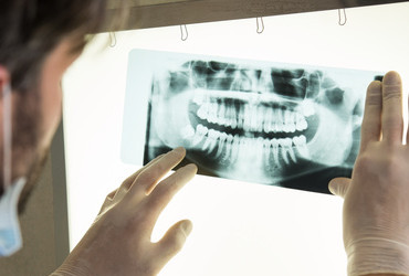Ambulatorio di Odontoiatria – Protesi dentali