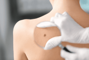 Ambulatorio Dermatologia